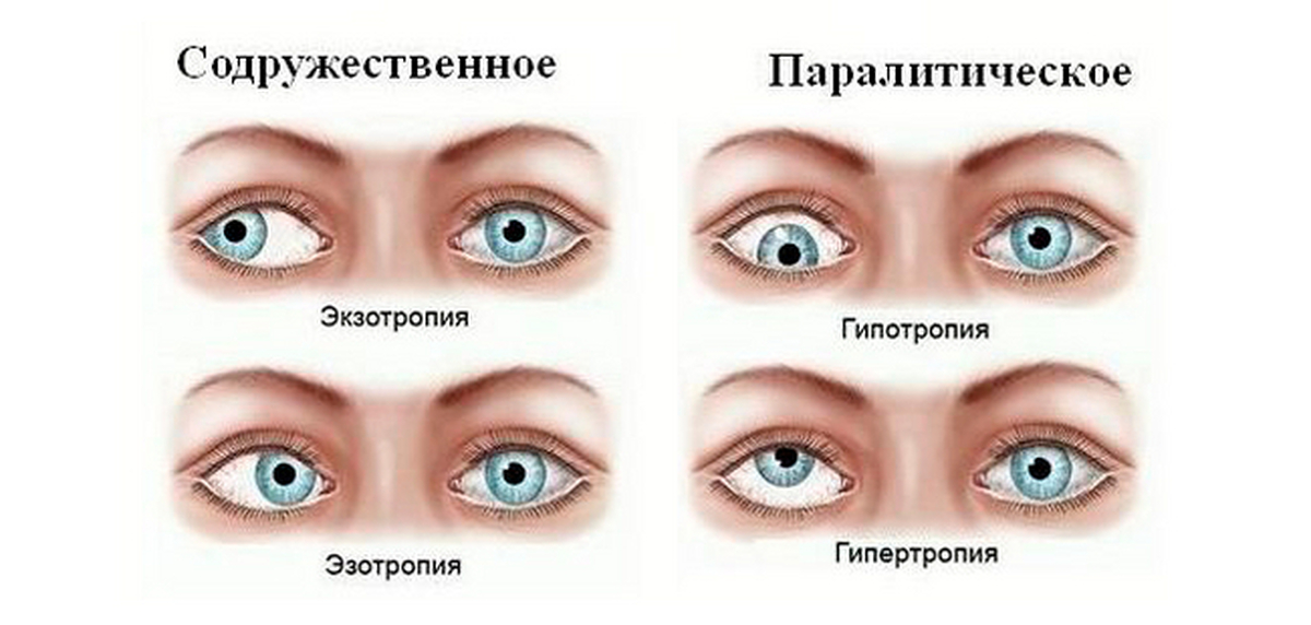 Какой глаз левый а какой правый