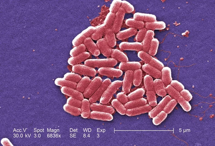 EVIL TWIN - My, Biology, The science, Nauchpop, Informative, Intestinal microflora, Bacteria, Bacteriology, Gut bacteria, The medicine, Infection, Longpost