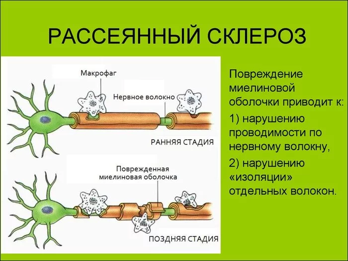 Продолжение поста «Моники. Институт по лечению рассеянного склероза. Москва, но не для москвичей, для области» - Моё, Больница, Врачи, Институт, Рассеянный склероз