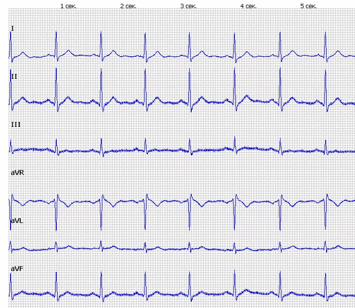 Cardiac arrest and defibrillator - My, Educational program, The medicine, Resuscitation, Heart, Longpost