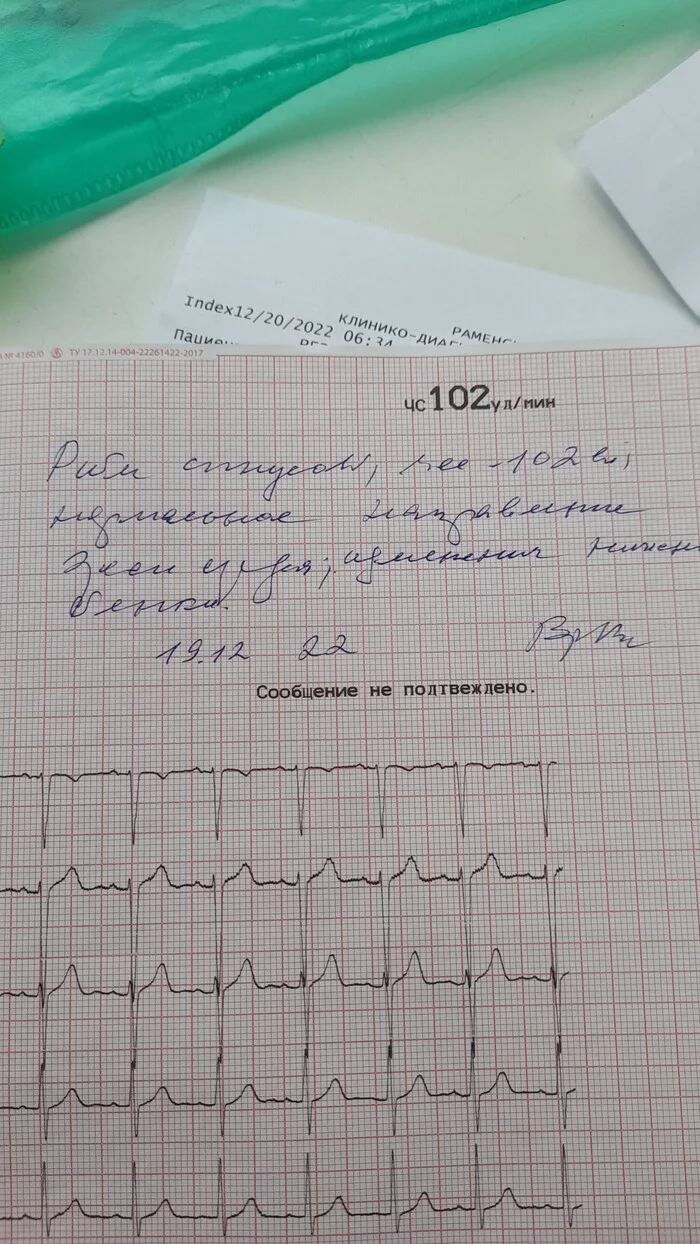 Goodnight! Can anyone please decipher - My, ECG, Pulse, Help, Doctor's handwriting