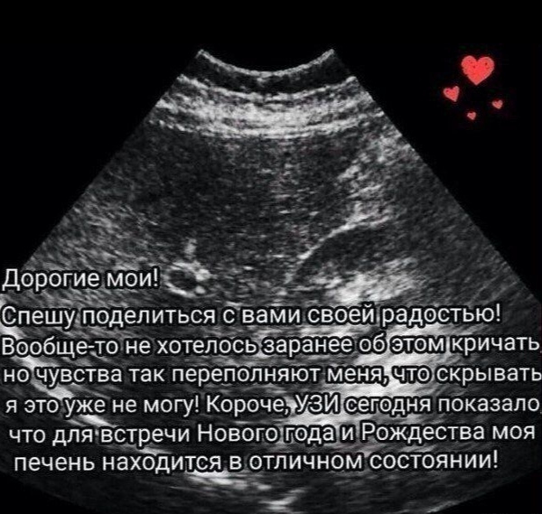 The old button accordion is relevant again - Christmas, Old, Ultrasound, Picture with text, Repeat