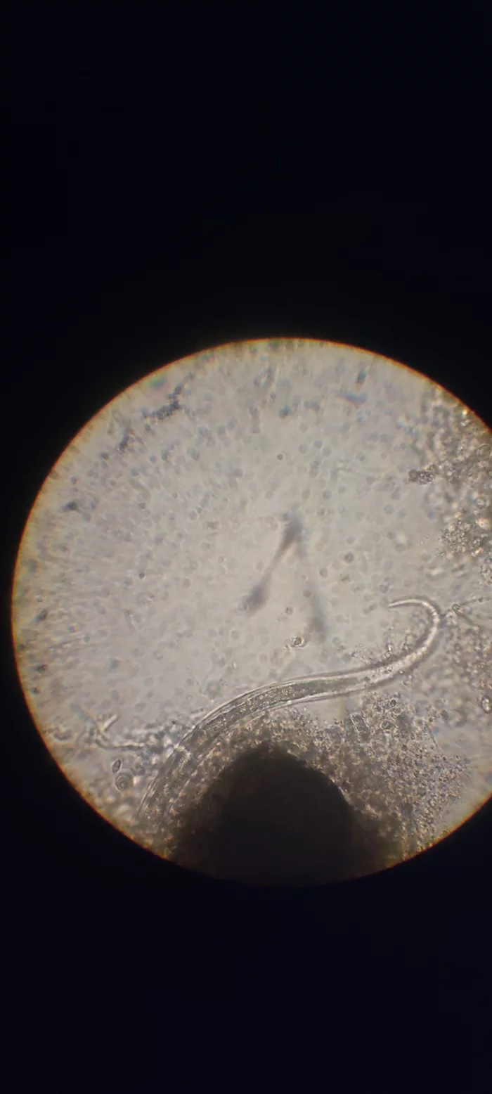 Tell me what kind of infusoria it is, it moves very often - Microbiology, Microscope, What's this?, Ciliates, Longpost