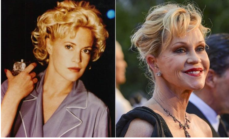 Stars before and after plastic surgery! - Celebrities, It Was-It Was, Longpost