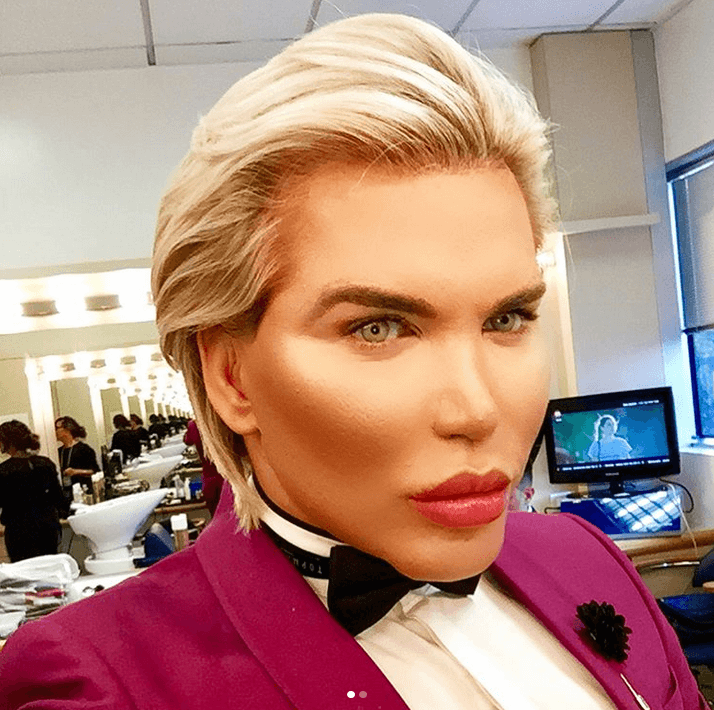 How to turn into a living Ken? Operation history of Rodrigo Alves. - My, Cosmetology, Plastic surgery, Face, The medicine, Fashion, beauty, Psychology, Longpost