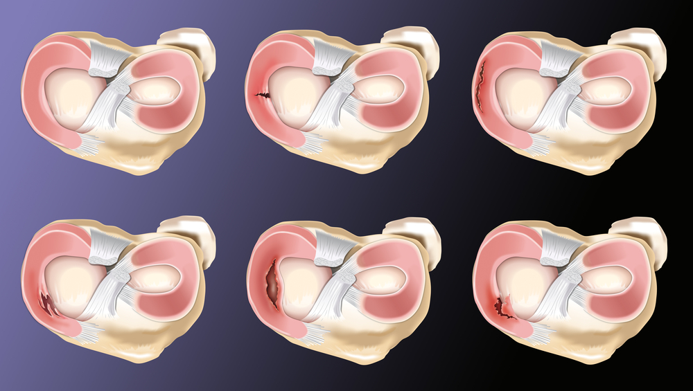 Arthroscopy - My, The medicine, Medicine in Russia, Longpost, Arthroscopy