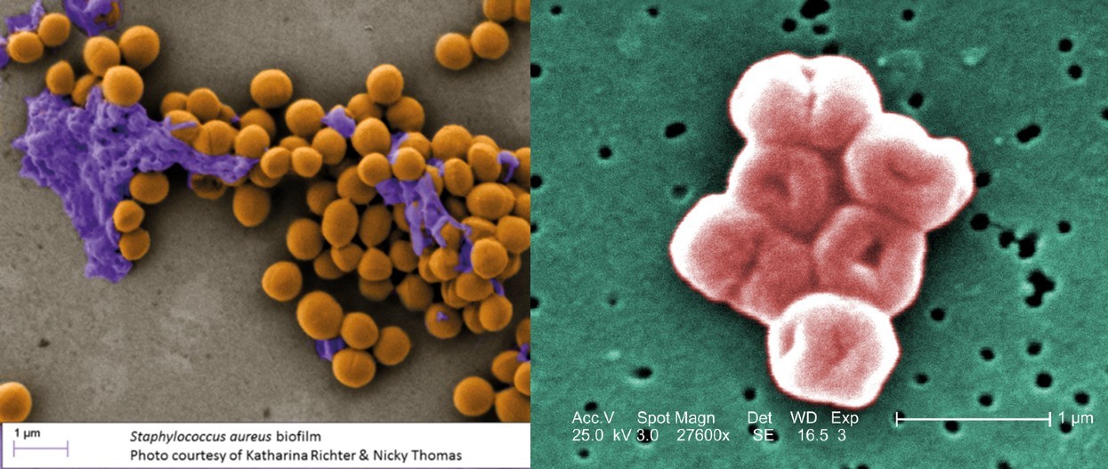 Antibiotics of the future or a future without antibiotics? - My, Antibiotics, Disease, Virus, Epidemic, Future, Longpost, Scientaevulgaris