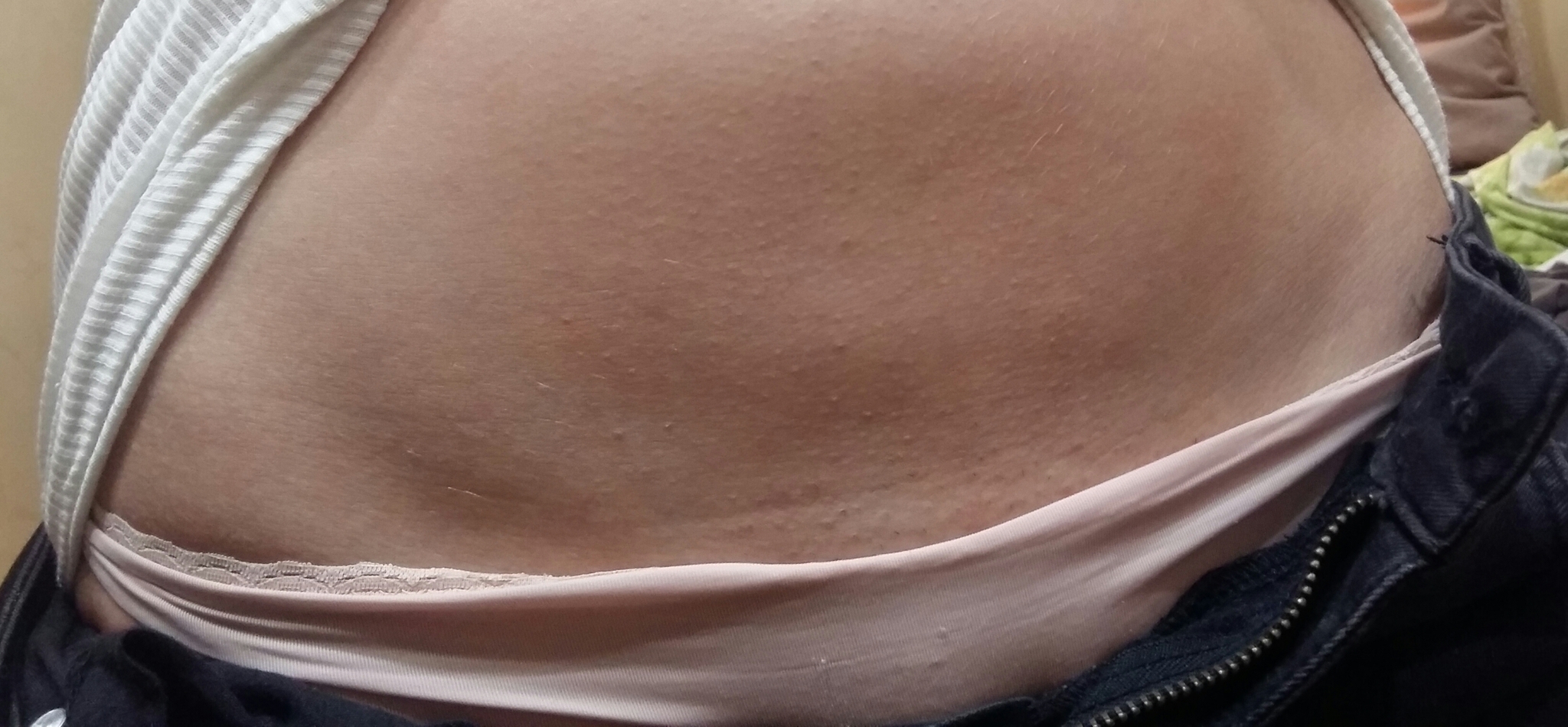 аллергия на груди у беременной фото 50