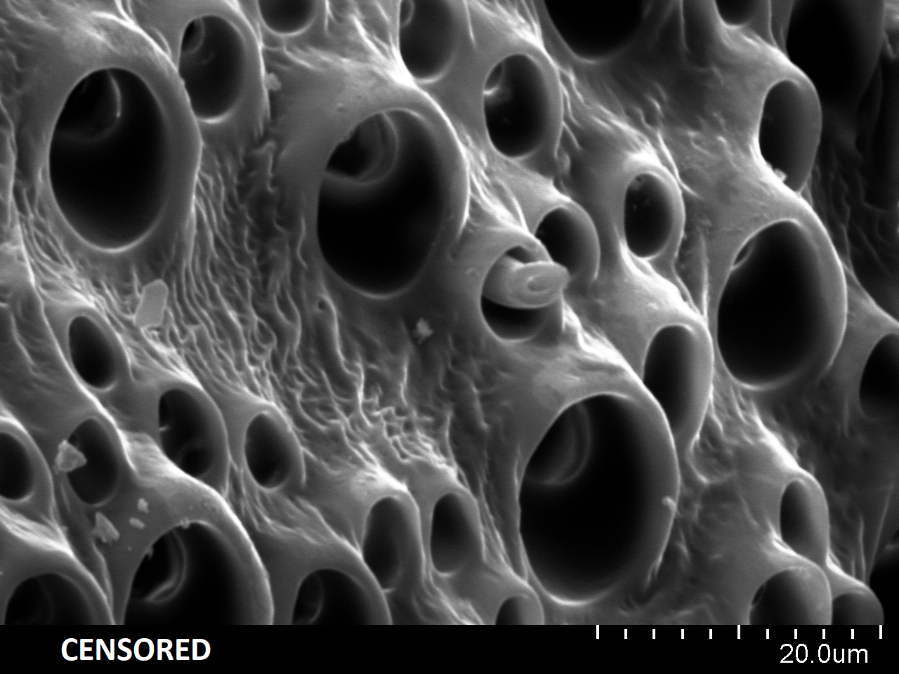 Увеличение 1600 крат микроскоп. Кровь под электронным микроскопом. Лапки бабочки под микроскопом. Лапки мотылька под микроскопом.
