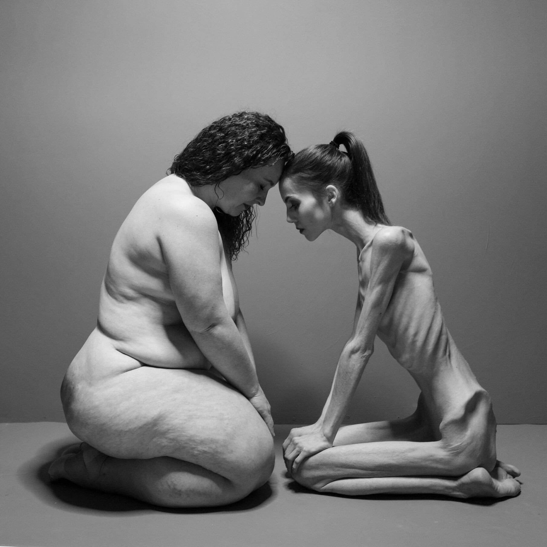 Two extremes - NSFW, The photo, Excess weight, Anorexia