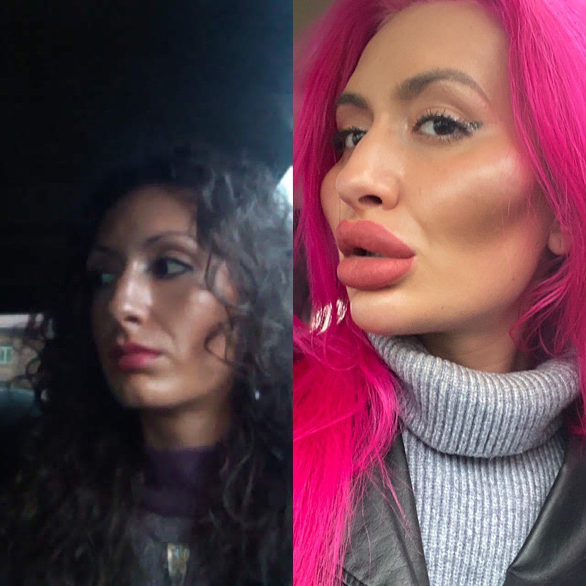 I'm from Instagram - Girls, Facial plastic surgery, Video, Longpost