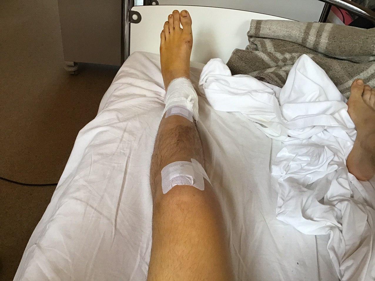 Continuation of the post “How I got into an accident and almost lost my leg” - My, Road accident, Velikiy Novgorod, Saint Petersburg, Fracture, Drunk Driver, Hospital, Negative, Alcohol, Mat, Video, Reply to post, Longpost