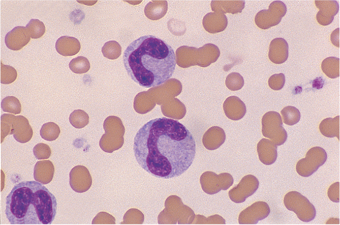 Blood under a microscope. Part 1. Red blood cells, neutrophils, basophils and eosinophils - My, The medicine, Histology, Microscope, Informative, Longpost