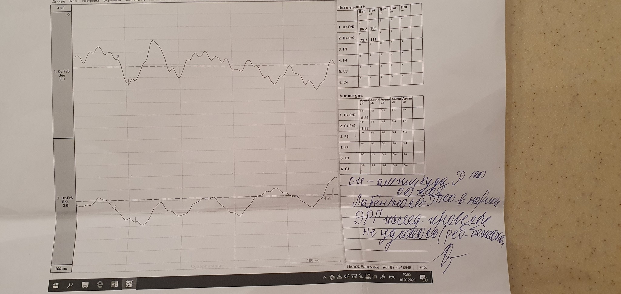 Need advice or help from an ophthalmologist - My, No rating, Help, Doctors, Text, Longpost