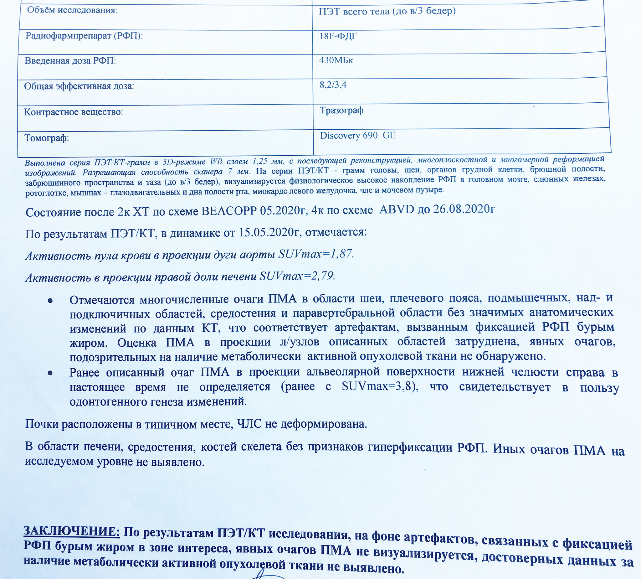 С. 81.1 Лимфома Ходжкина нодулярный склероз NS II (2 тип) - Моё, Лимфома Ходжкина, Онкология, Длиннопост, Рак и онкология, Лечение, Химиотерапия