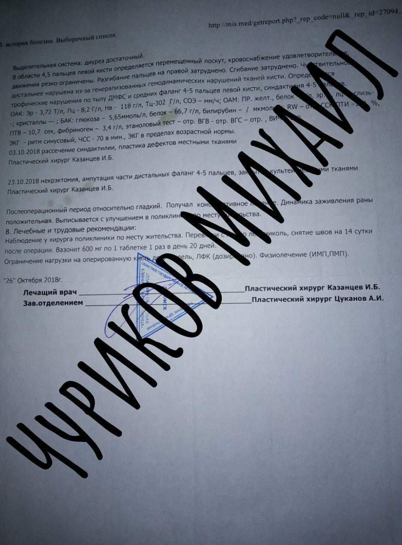 СБОР СРЕДСТВ НА СИЛОВОЙ, АКТИВНЫЙ, МЕХАНИЧЕСКИЙ ПРОТЕЗ ПАЛЬЦЕВ!!! - Моё, Протез, Благодарность, Длиннопост, Сбор, Титан, 3D, 3D моделирование