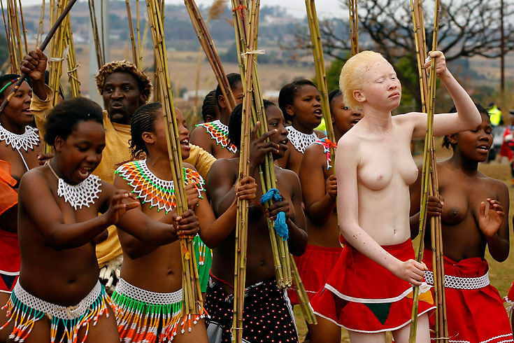 When your comment did not coincide with the opinion of others and gained minuses - NSFW, Girls, Boobs, Africa, Albino