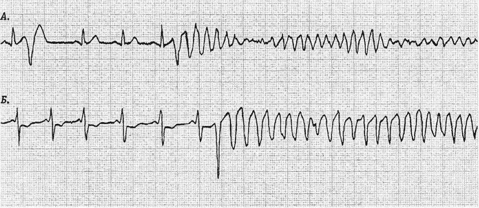 Physiology. Myths and misconceptions #7: clinical death (cardiac arrest) - Resuscitation, Cardiac arrest, Clinical death