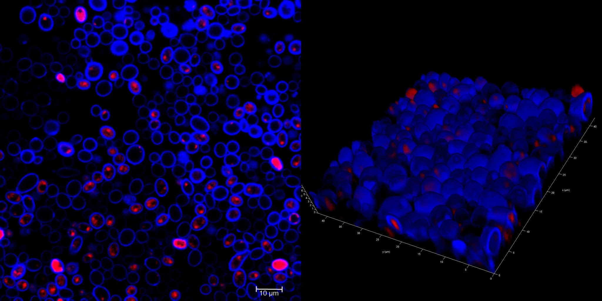 How to see biofilm - My, Scientific photo contest, Confocal microscopy, Longpost, The medicine, The science, Microbiology