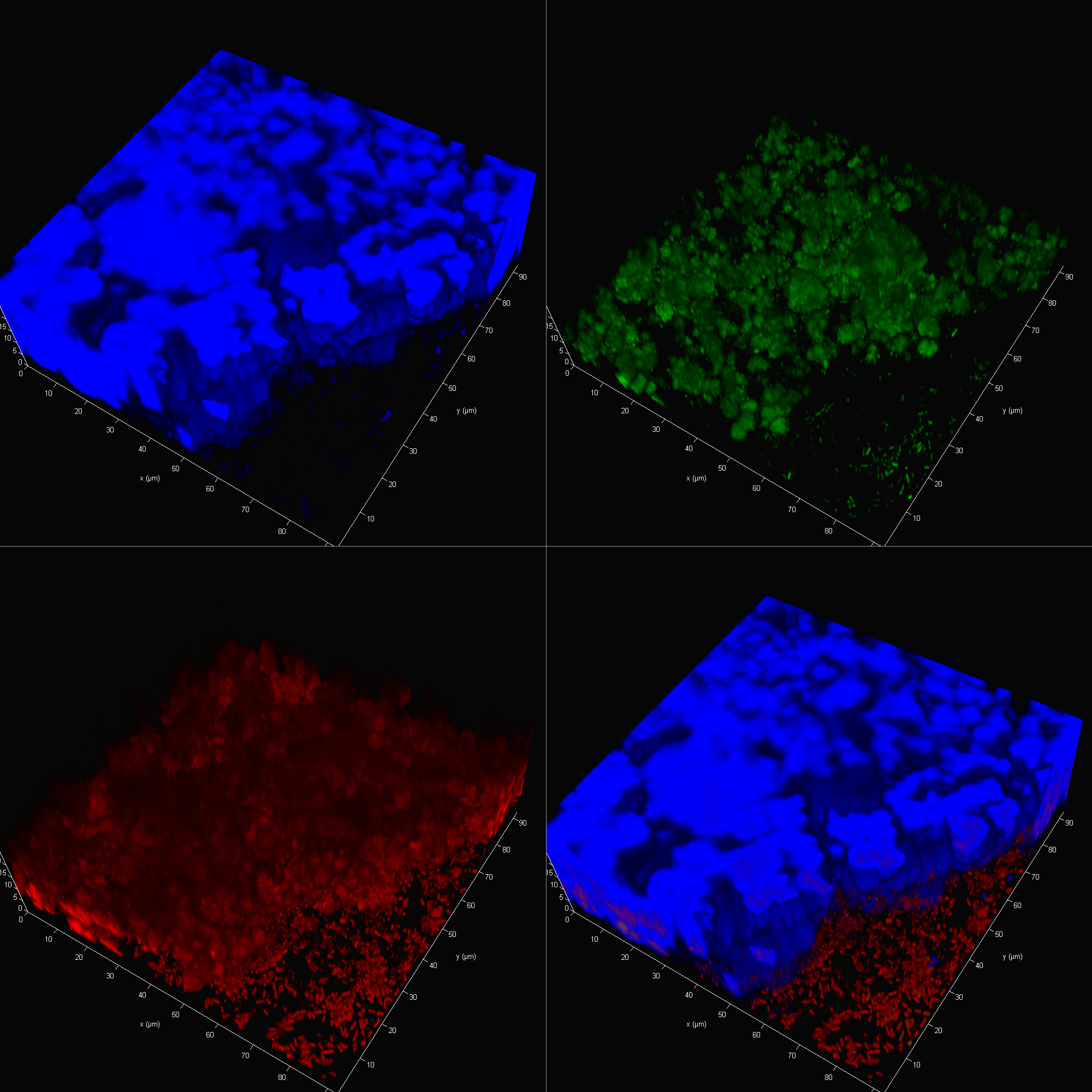 How to see biofilm - My, Scientific photo contest, Confocal microscopy, Longpost, The medicine, The science, Microbiology