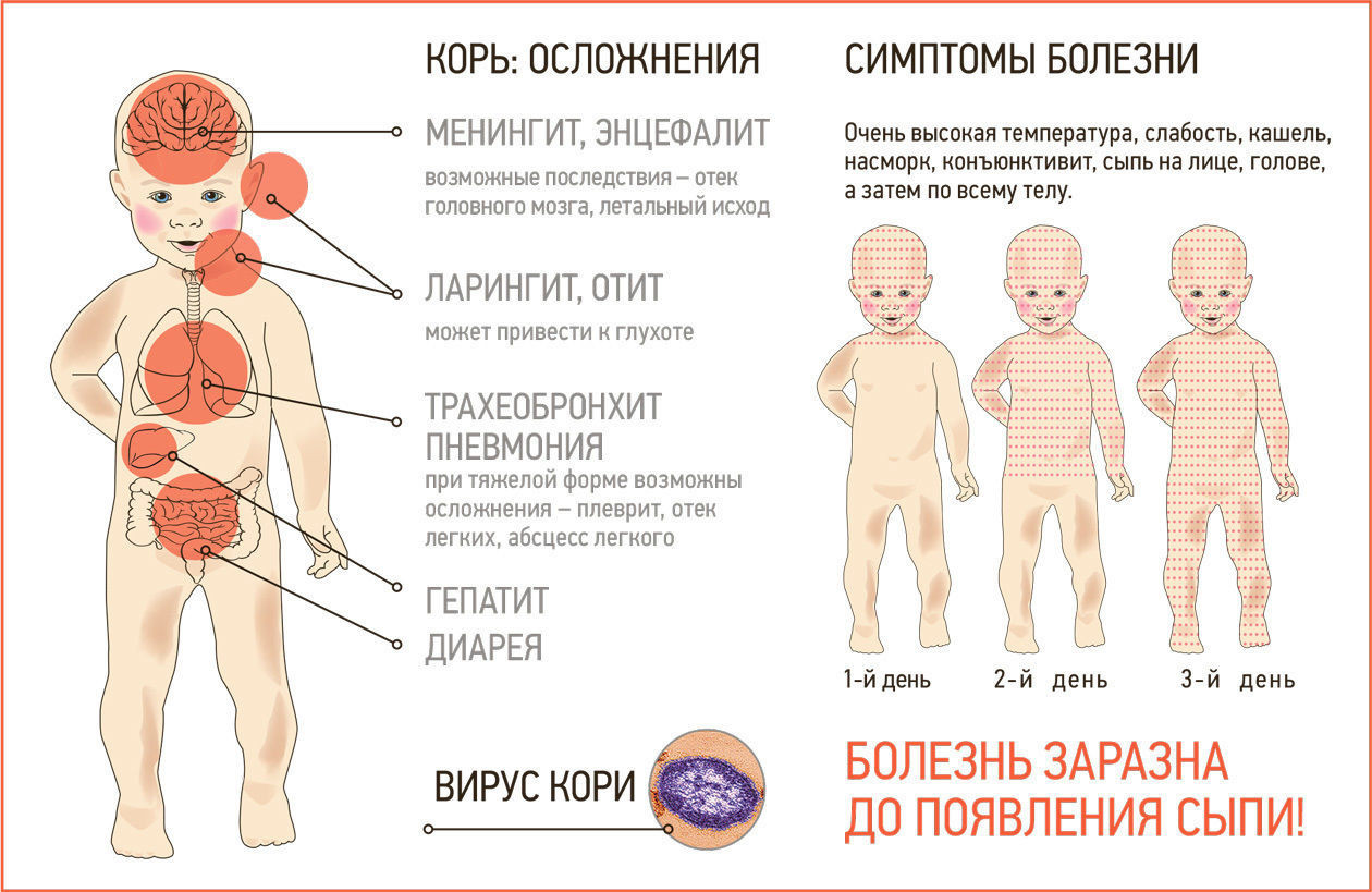 Сыпь у ребенка: какие органы нужно лечить?