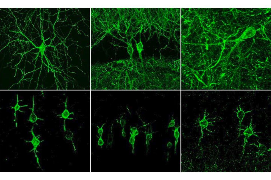 Neurology at a first glance. Neuron - My, Nauchpop, The medicine, Health, Neurons, Longpost