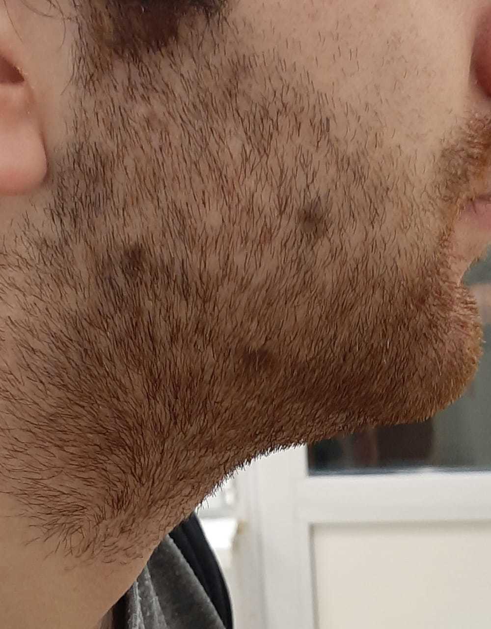 Основные этапы роста бороды