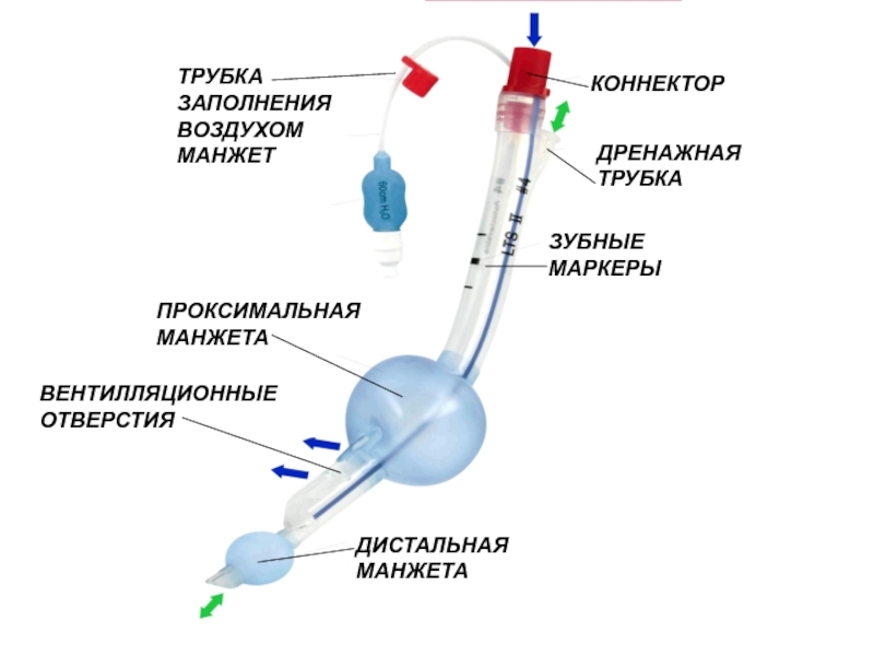 Why doesn’t my throat hurt after mechanical ventilation? - Anesthesiology, Pain, Longpost