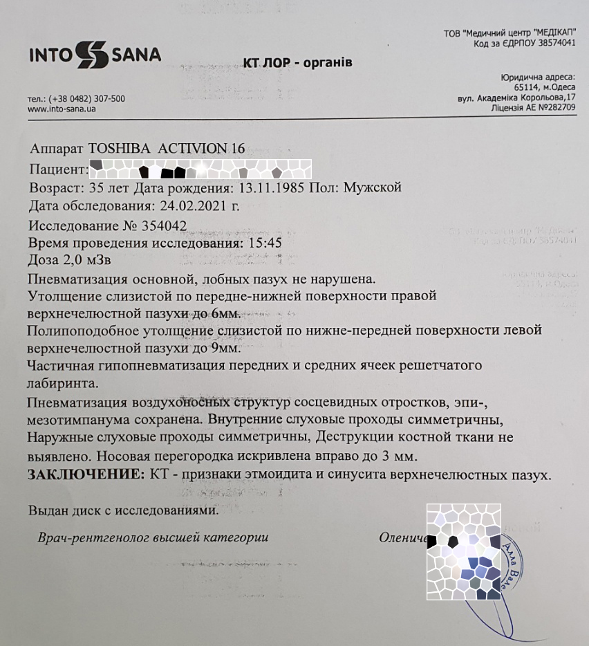 Продолжение поста «Привет, меня зовут Astart13 и я наркоман!» - Моё, Вазомоторный ринит, Операция, Наркомания, Спрей для носа, Привыкание, Ответ на пост, Длиннопост, Септопластика