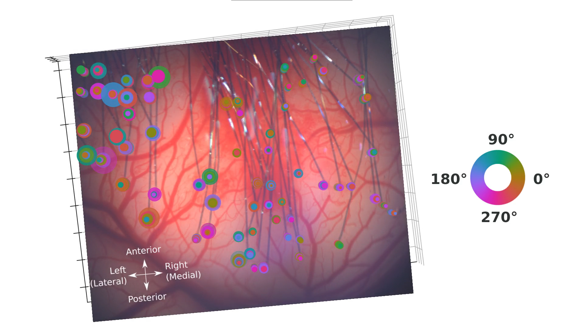 A specialist in neural interfaces explained what is remarkable about the demonstration of a neuroimplant from Neuralink by Elon Musk - Neuralink, Neural Interface, Neurobiology, Neurosurgery, USA, Technologies, Phd, The science, The medicine, Elon Musk, Video, Longpost