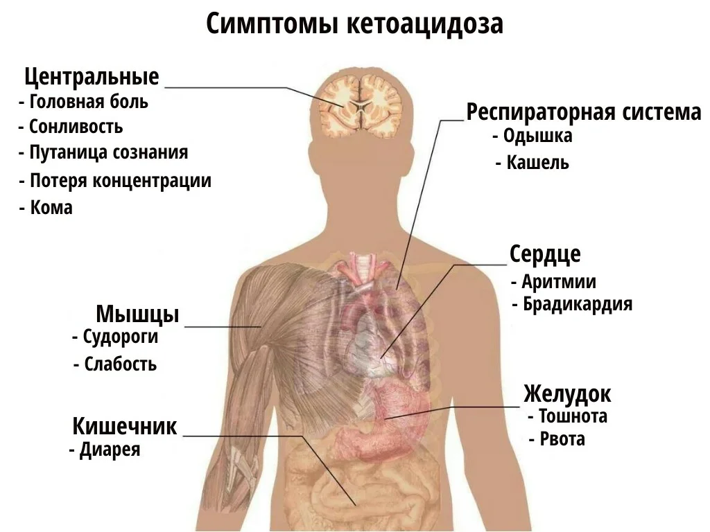 Кружится голова от сахара