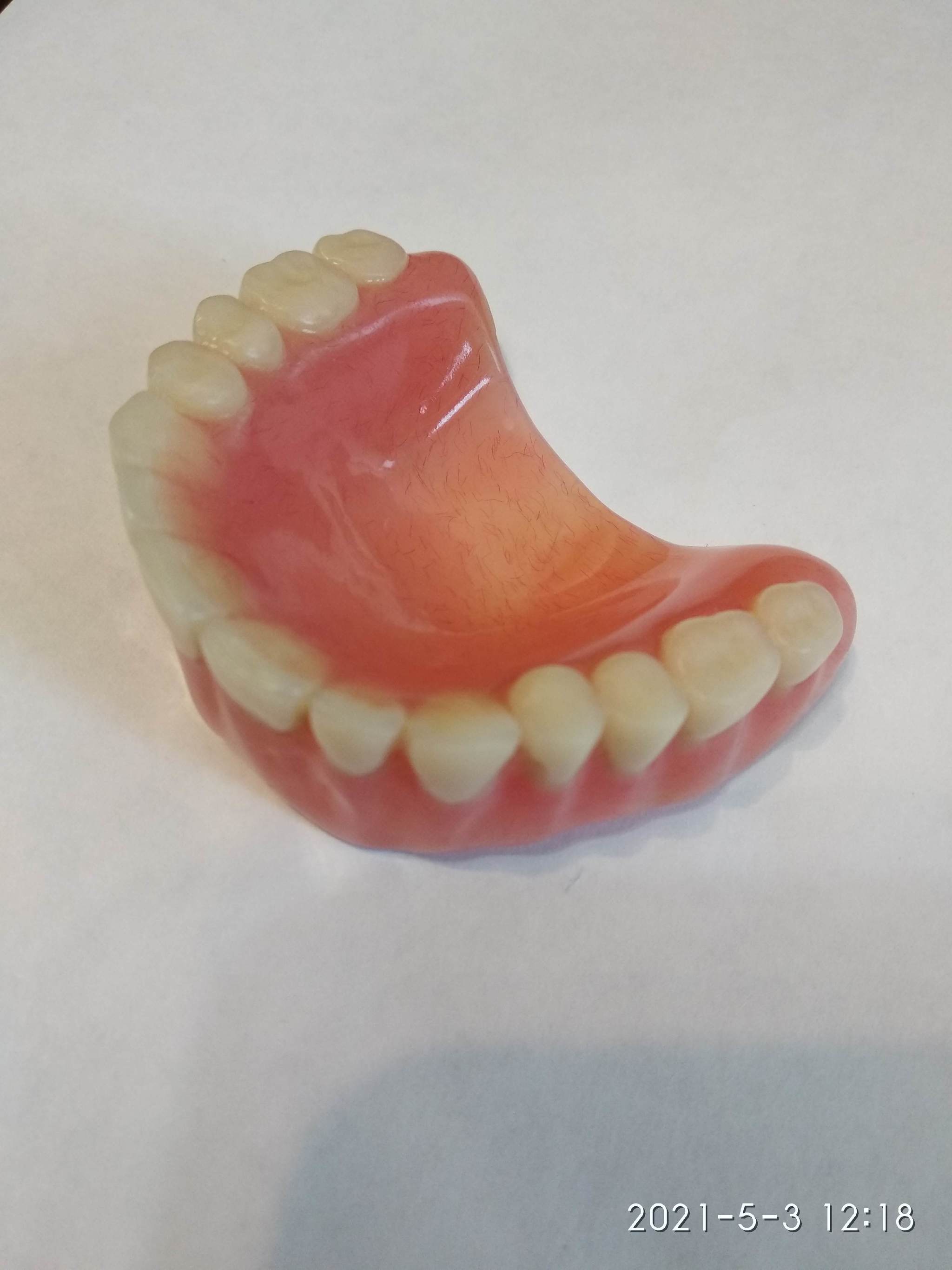 Teeth, or rather artificial teeth. Part 3 - My, Dentistry, Teeth, Longpost