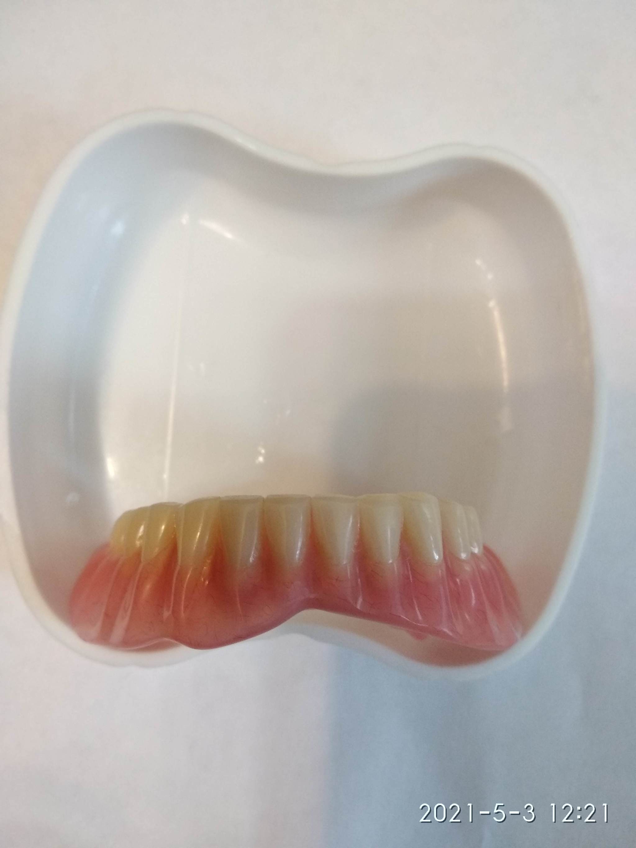 Teeth, or rather artificial teeth. Part 3 - My, Dentistry, Teeth, Longpost