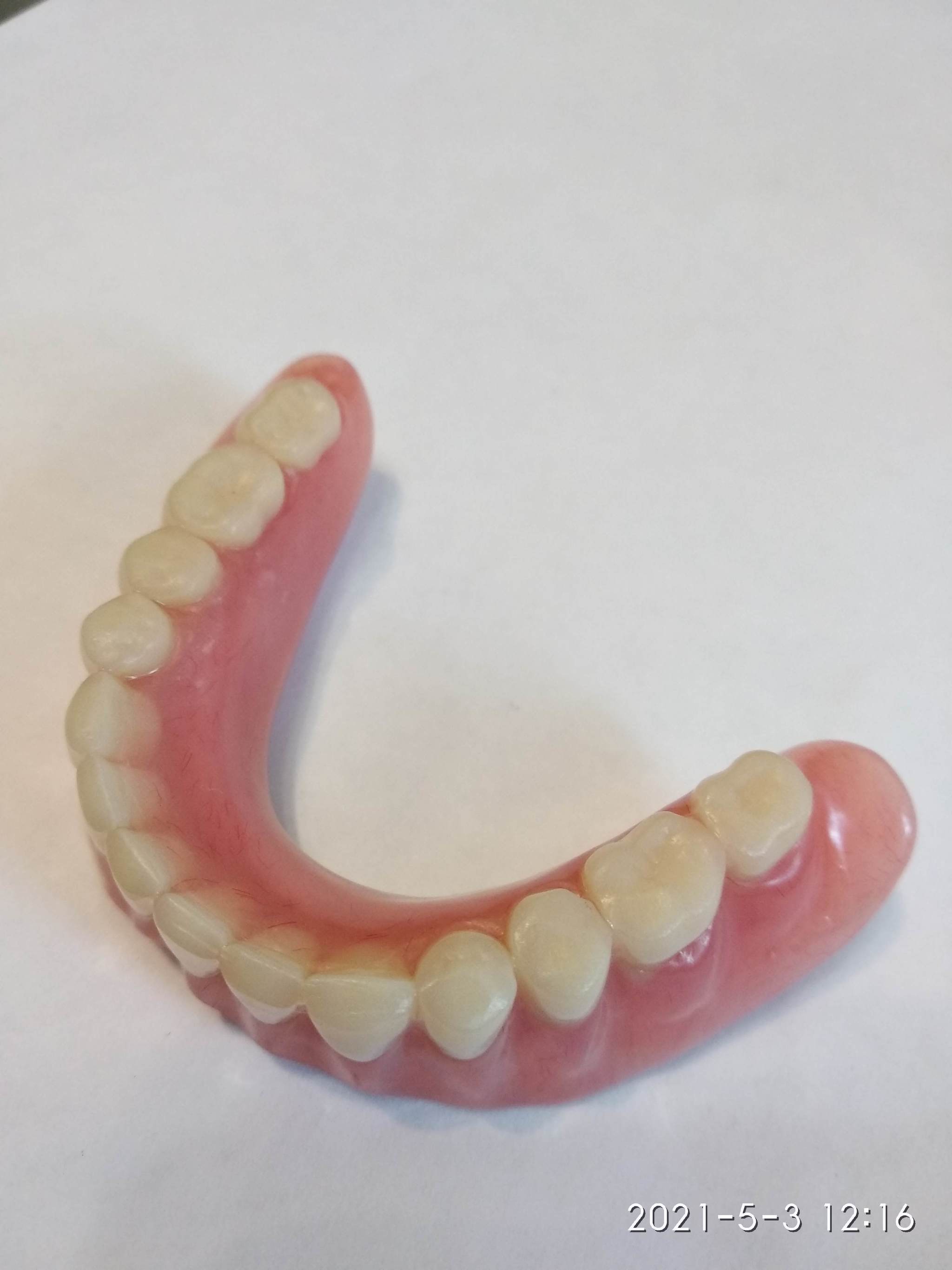 Teeth, or rather artificial teeth. Part 3 - My, Dentistry, Teeth, Longpost