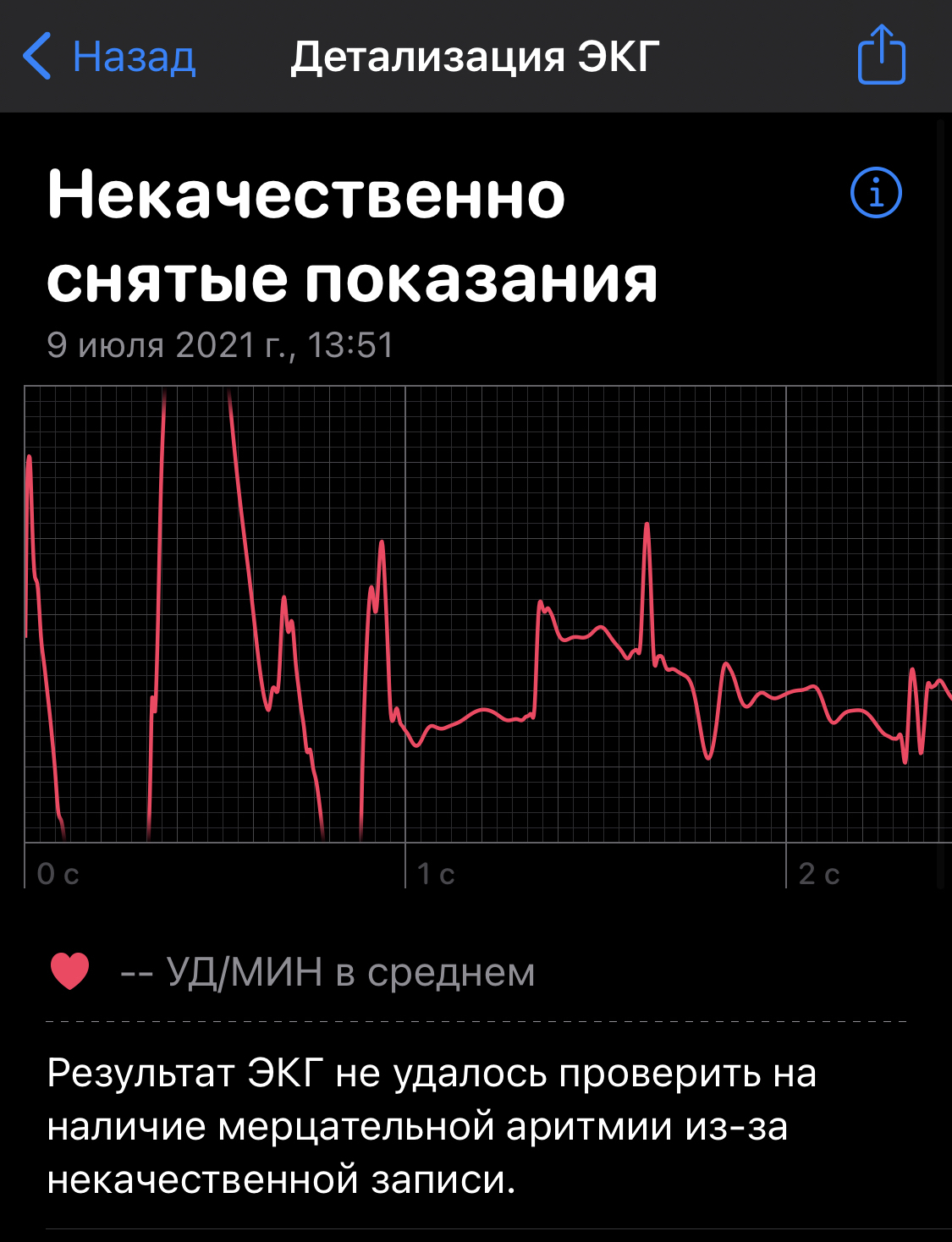 Electric shock and Apple Watch - My, ECG, Apple Watch, Longpost