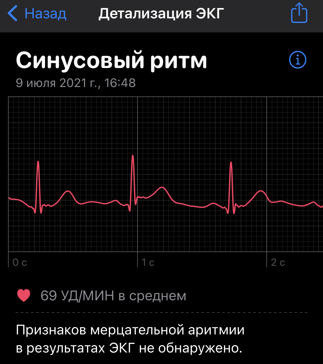 Electric shock and Apple Watch - My, ECG, Apple Watch, Longpost