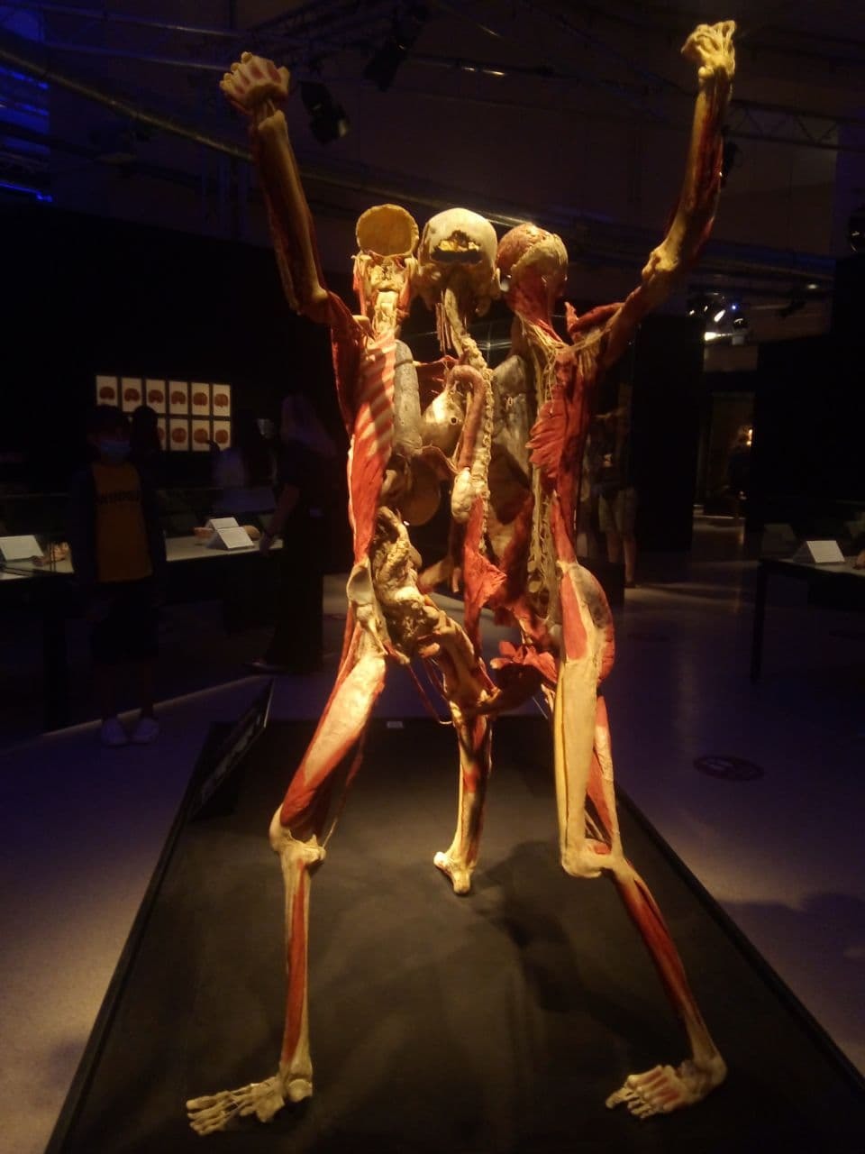 Mummies Museum Moscow - My, VDNKh, Anatomy, Education, 12+, Longpost, Plastination, GГјnther von Haggens