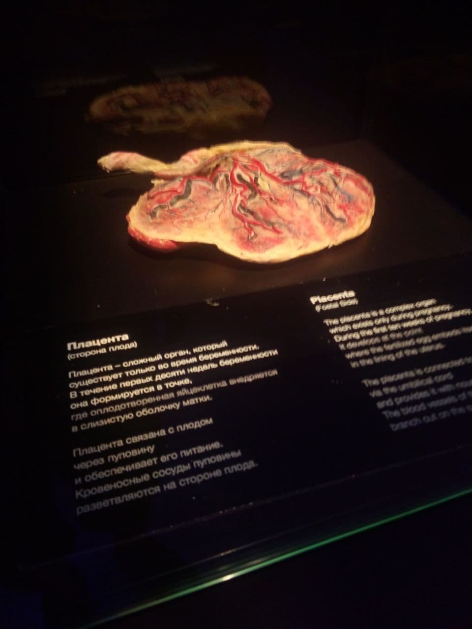 Mummies Museum Moscow - My, VDNKh, Anatomy, Education, 12+, Longpost, Plastination, GГјnther von Haggens