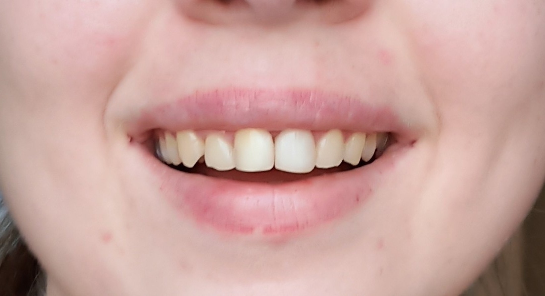 Need help - My, Dentistry, Teeth