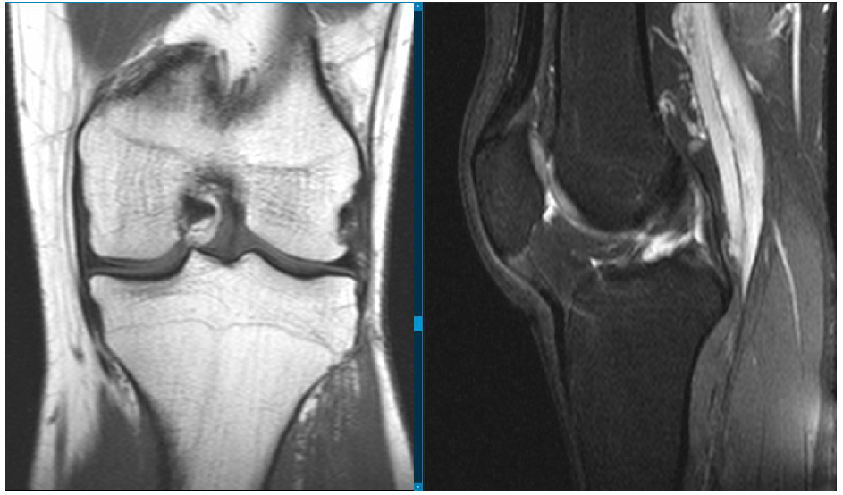 Initiation into the thirties club - My, MRI, 30 years, Age