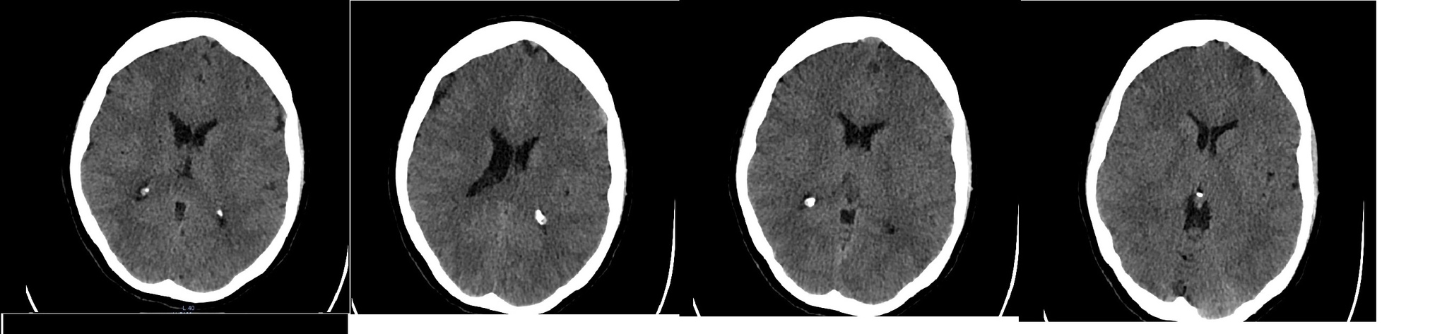 brain CT - The medicine, Brain, Doctors