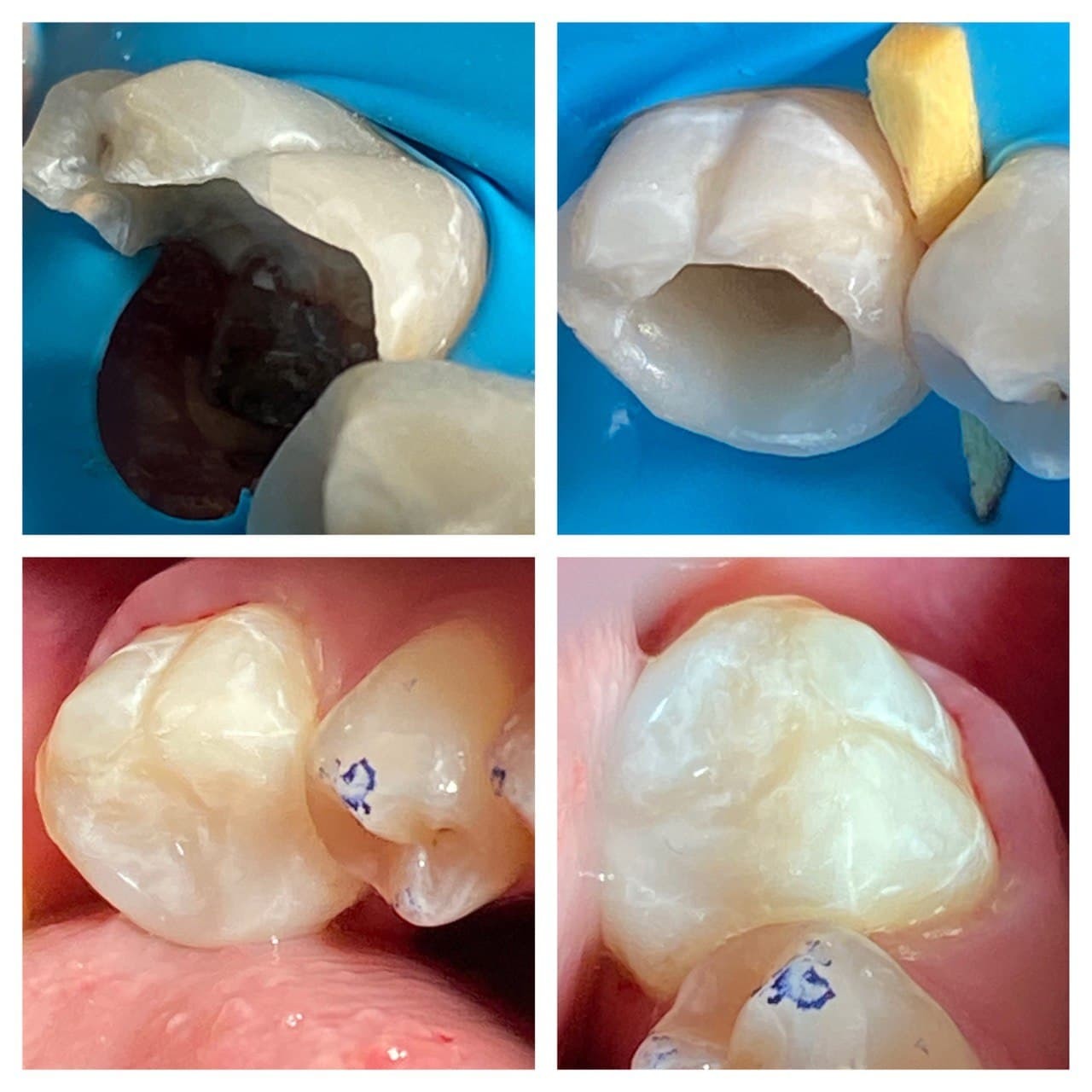 Response to the post Skillful Tooth Restoration - The medicine, Teeth, Dentistry, Reply to post, My