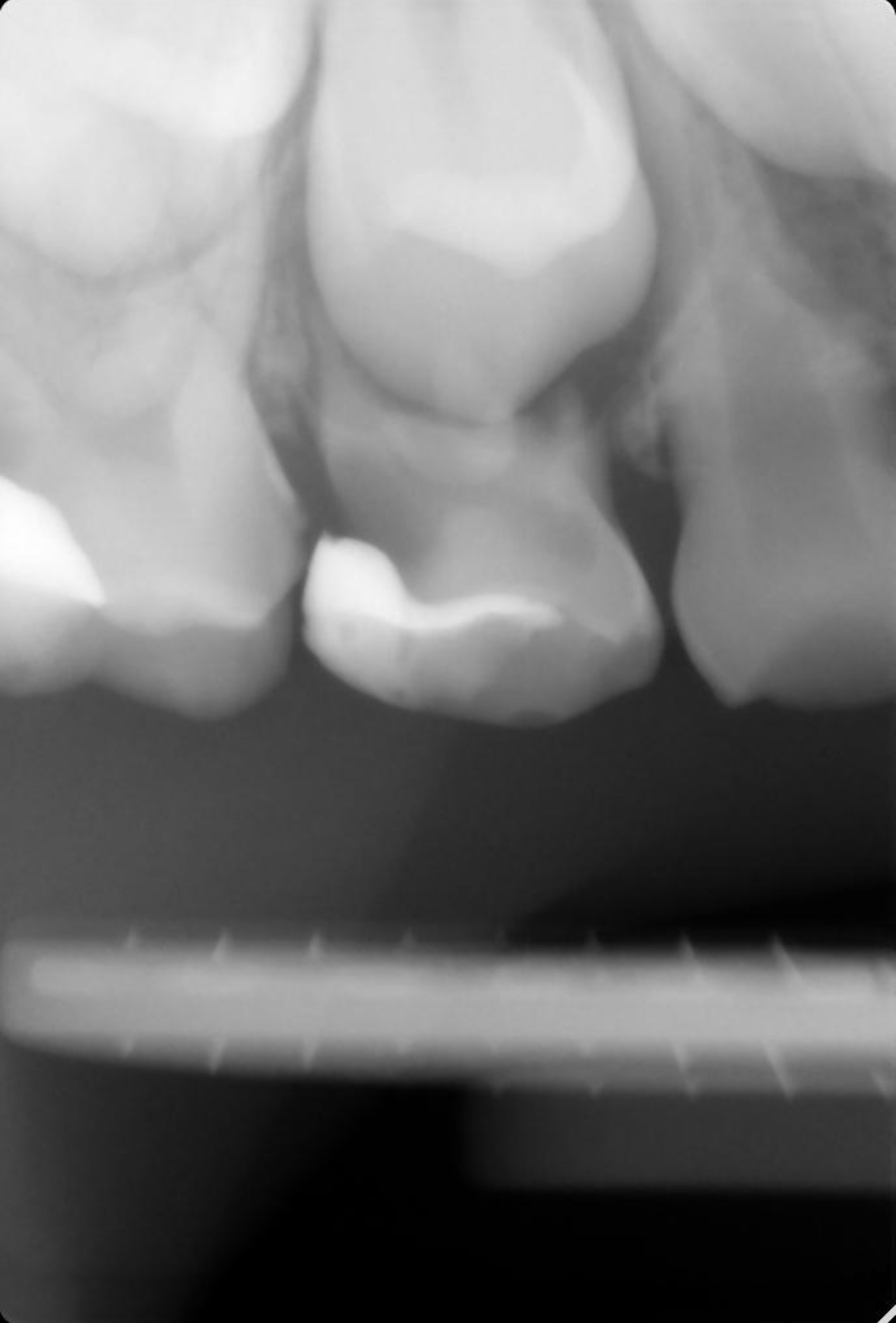 Tooth treatment for 22.5 tr - Dentistry, Check, Longpost, Question