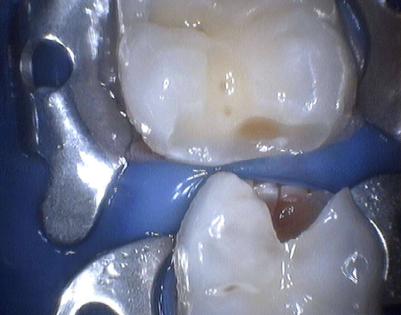 Tooth treatment for 22.5 tr - Dentistry, Check, Longpost, Question