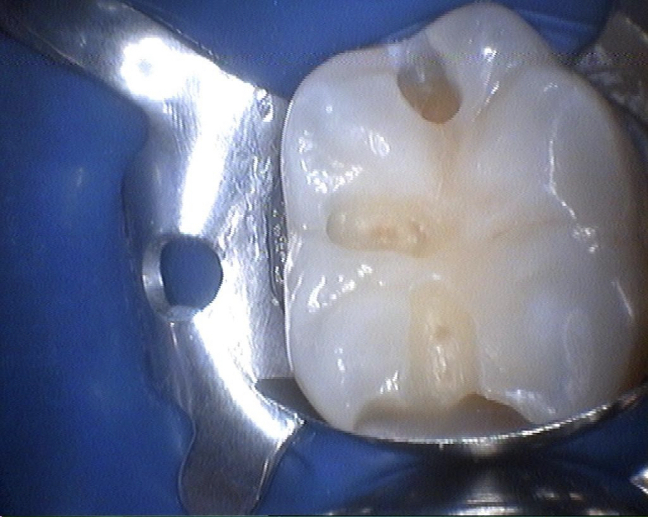 Tooth treatment for 22.5 tr - Dentistry, Check, Longpost, Question