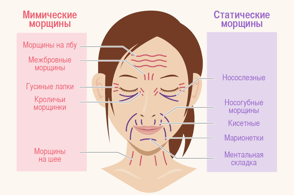 The story of how to get and cure acne - My, Longpost, Text, Acne, Acne, Treatment, Life stories