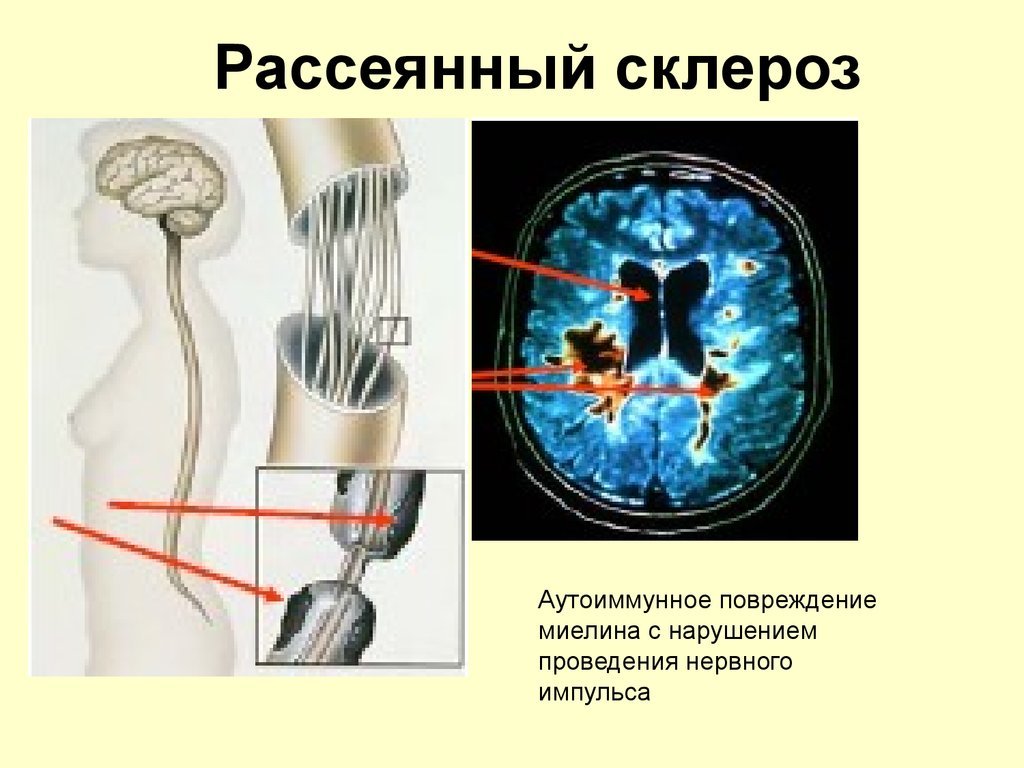 Continuation of the post Monica. Institute for the Treatment of Multiple Sclerosis. Moscow, but not for Muscovites, for the region - My, Hospital, Doctors, Institute, Multiple sclerosis, Reply to post