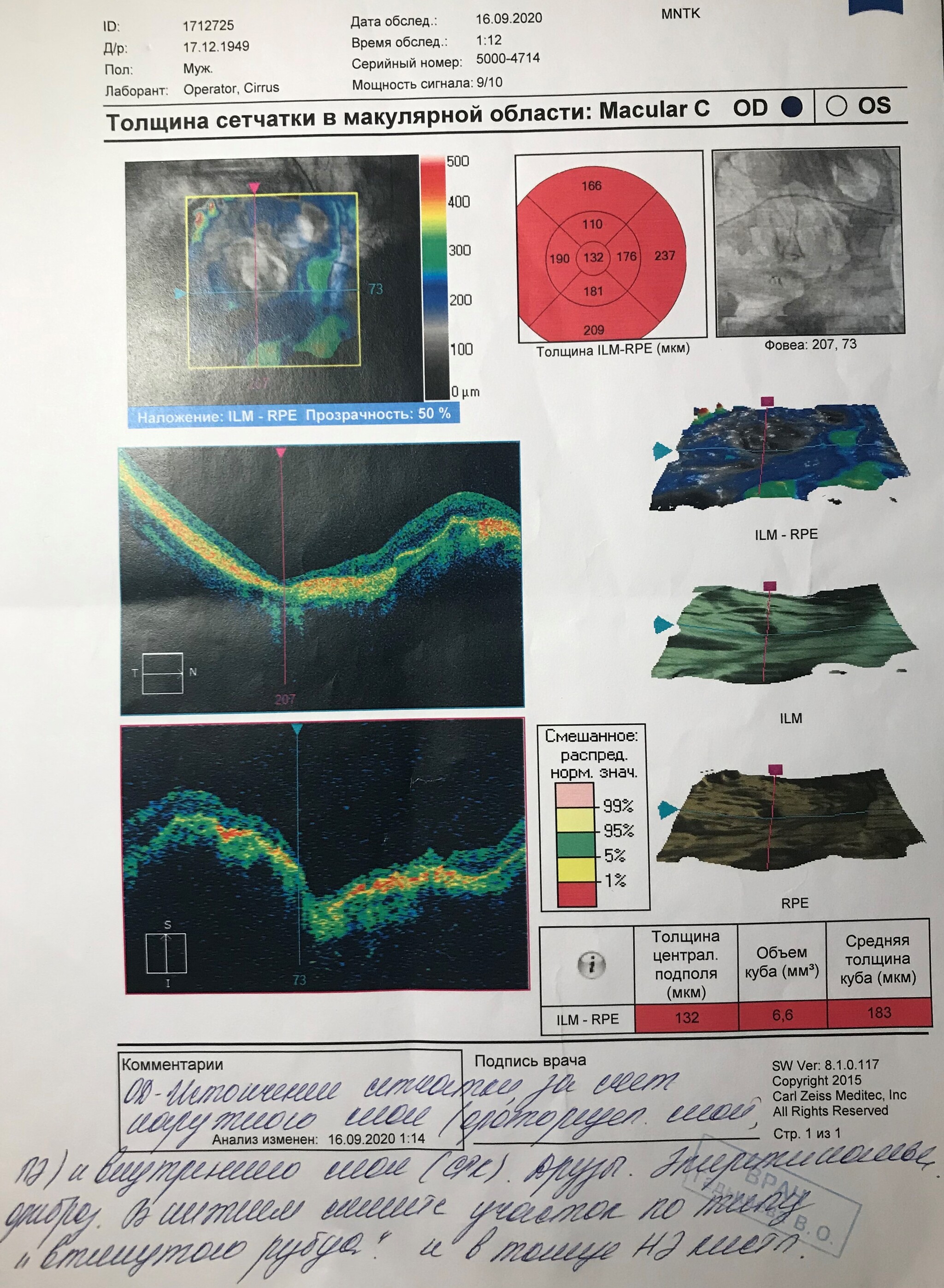 Grandpa is rapidly losing his sight - My, No rating, Ophthalmology, Consultation, Need advice, The strength of the Peekaboo, Poor eyesight, Longpost, Doctors need help, 