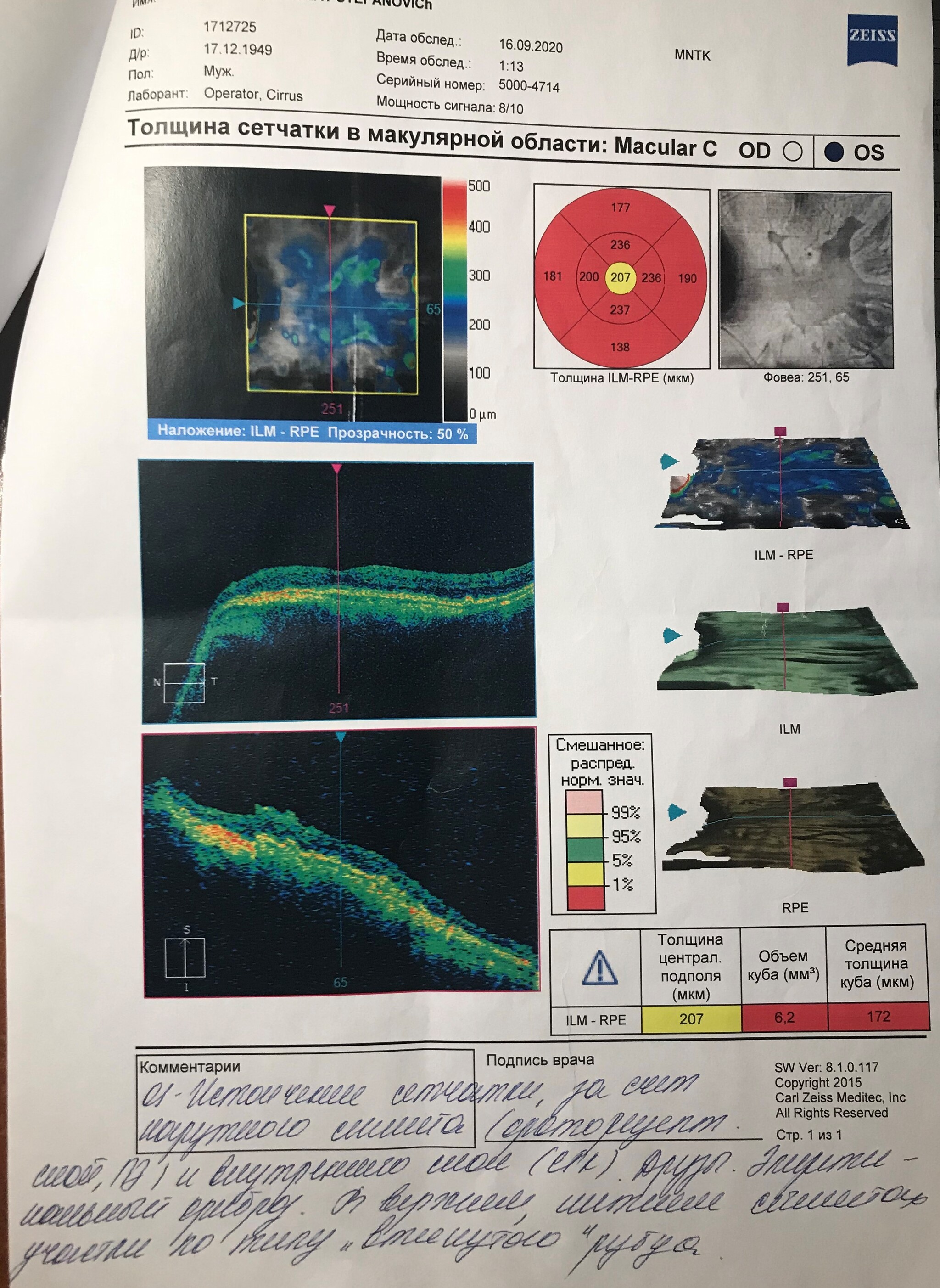 Grandpa is rapidly losing his sight - My, No rating, Ophthalmology, Consultation, Need advice, The strength of the Peekaboo, Poor eyesight, Longpost, Doctors need help, 