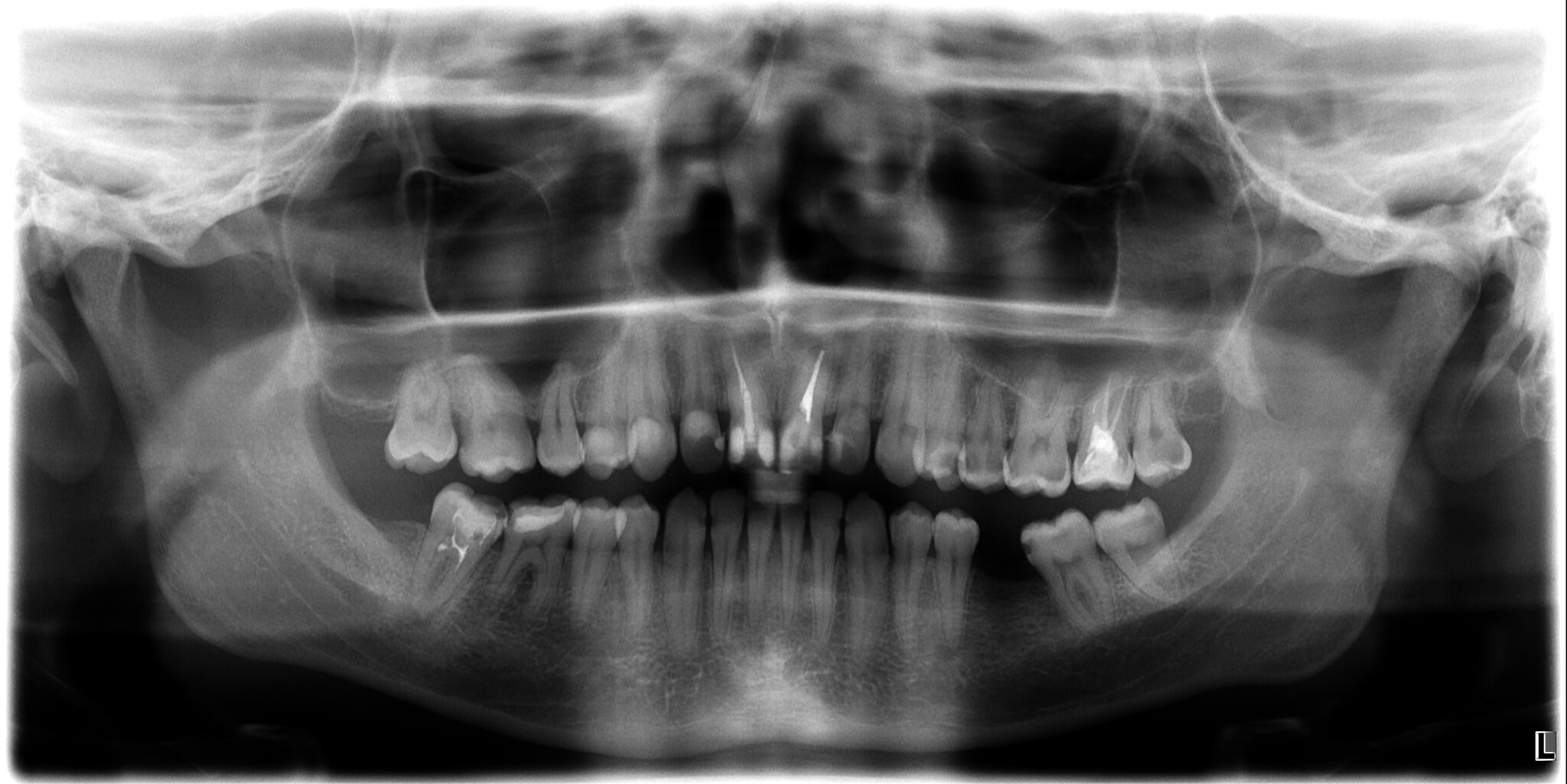 Where to begin? - My, Bad teeth, Consultation, Doctors need help